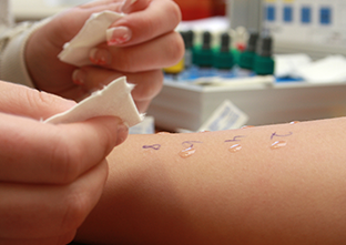 Test allergie su antigeni inalanti