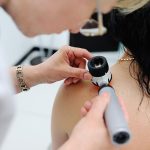 Melanoma, studio Iqvia: meno di un italiano su 4 controlla i nei